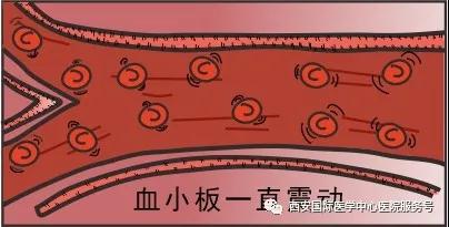 血小板是正常值的三倍？專家提醒小心血栓和出血！