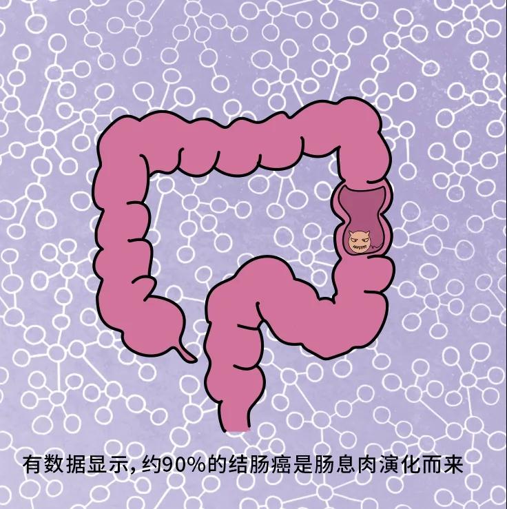 奪走“黑豹”生命的結(jié)腸癌，到底什么來頭？