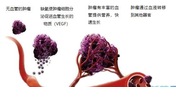 晚期腫瘤為什么會復發轉移？