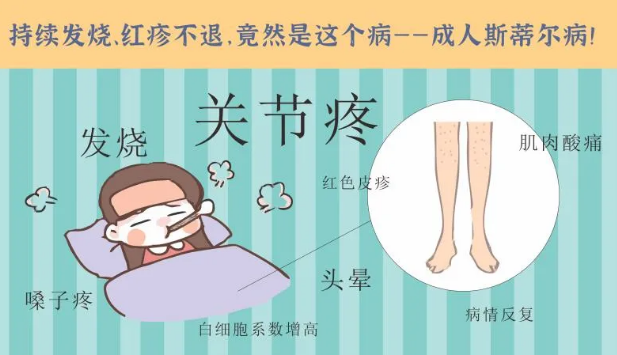 持續(xù)發(fā)燒、紅疹不退……她終于在這里治好了這個(gè)罕見病