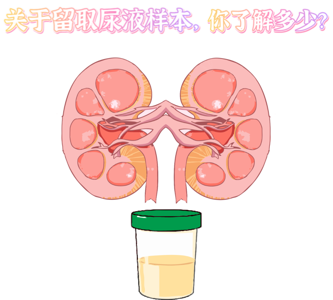 做尿檢，不得不說的注意事項(xiàng)！