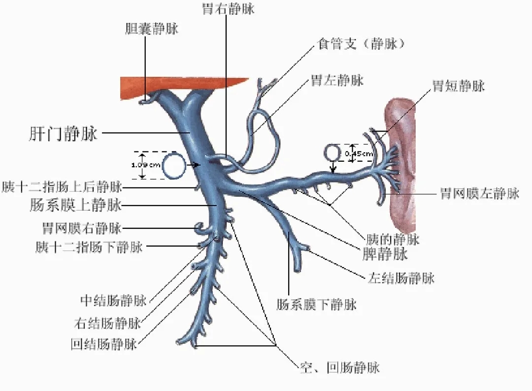 反復嘔血、黑便怎么辦？TIPS手術能解決