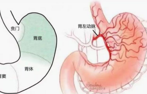 不開刀不吃藥不餓肚子，微創介入減肥靠譜嗎？