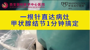 1根針直達病灶 甲狀腺結節1分鐘搞定